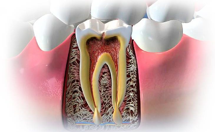 Киста зуба: чем она опасна и что делать