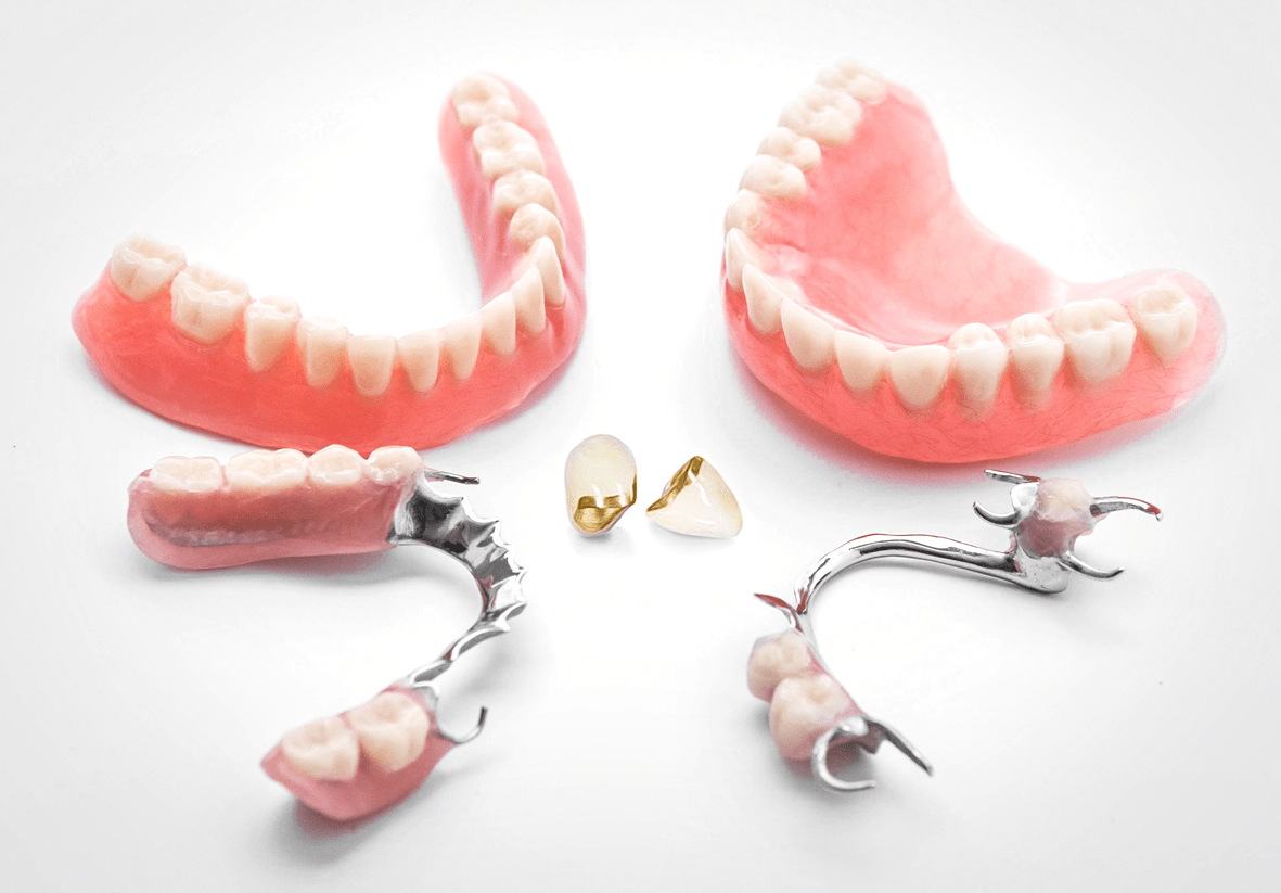 Ошибки при выборе протезов зубов и как их избежать