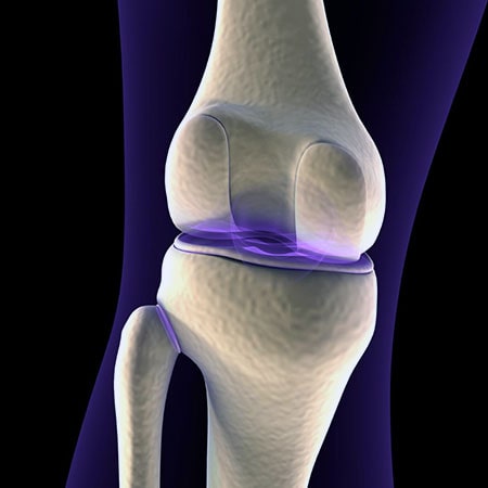 Методы лечения заболеваний суставов — эффективные способы решения проблемы.